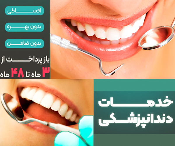 بهترین مرکز تخصصی لمینت دندان در کرج